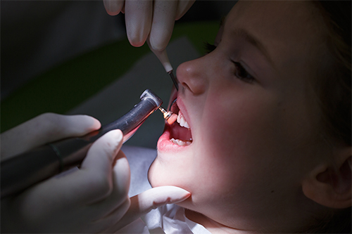 Cosmetic dentistry procedures for children