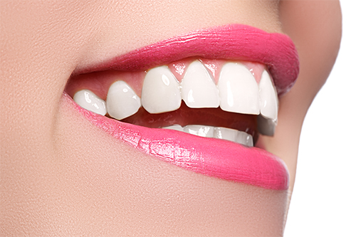 Healthy teeth after cosmetic dentistry procedure